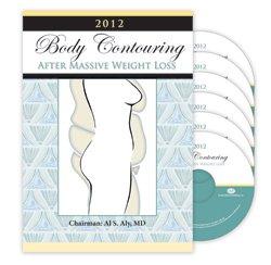 2012 Aly Body Contouring Sawise Rapat Mundhut Bobot Massive | Kursus Video Medis.
