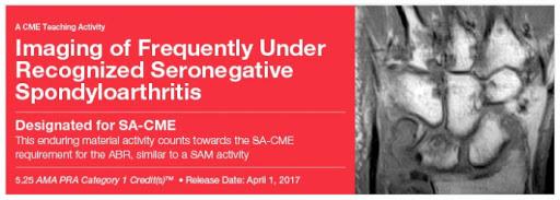 2017 imaging of frequently under recognized seronegative spondyloarthritis | Medical Video Courses.