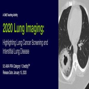 Ang 2020 Lung Imaging Highlighting Lung Cancer Screening ug Interstitial Lung Disease | Mga Kurso sa Video nga Medikal.