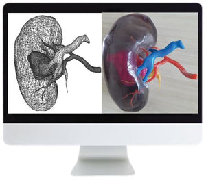 Impressão 3D ARRS de modelos anatômicos: Oportunidade de valor agregado para a radiologia 2019 | Cursos de vídeo médico.