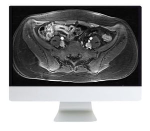 ARRS, um guia para exames de imagem do intestino 2019 | Cursos de vídeo médico.