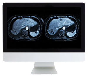 ARRS Resonancia magnética abdominal e pélvica | Cursos de vídeo médico.