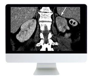 ARRS Pautas aplicadas á imaxe abdominal e torácica aplicadas: evidencias fronte a opinión 2021 | Cursos de vídeo médico.