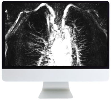 ARRS Advanced Chest Imaging 2019 | Medical Video Courses.