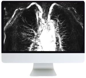 Chụp ảnh lồng ngực nâng cao ARRS 2019 | Các khóa học video y tế.
