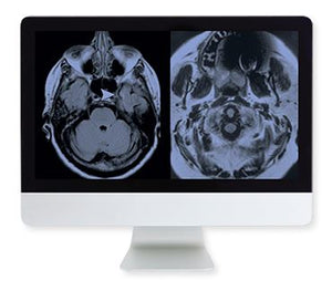 日常成像中的ARRS伪影和物理-基于案例的方法在线课程2015 | 医学视频课程。