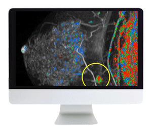 Perles et pièges de l'imagerie mammaire ARRS: approches d'imagerie traditionnelles et nouvelles 2020 | Cours de vidéo médicale.