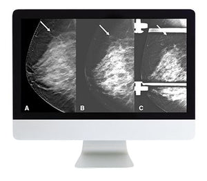 ARRS乳房成像：筛查和诊断医学视频课程。