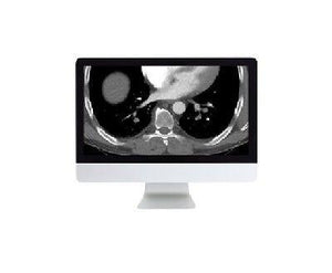 ARRS Clinical Cardiopulmonary Imaging Review 2018 | Cursos de vídeo médico.