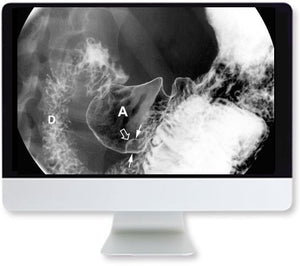 ARRS Klinisk casebaseret gennemgang af abdominal billeddannelse 2019 | Medicinske videokurser.