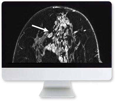ARRS Clinical Case-Based Review of Breast Imaging 2019 | Medical Video Courses.
