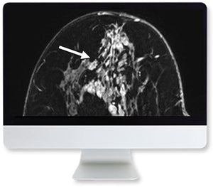 ARRS клинички преглед заснован на случај на слика на дојка 2019 | Курсеви по медицинско видео.