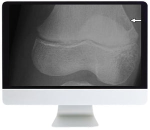 ARRS Clinical Case-Based Review of Musculoskeletal Imaging 2019 | Cursos de vídeo médico.