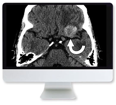 ARRS Clinical Case-Based Review of Neuroradiology 2019 | Medical Video Courses.