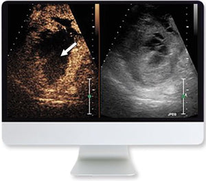 ARRS klinički pregled ultrazvuka zasnovan na slučaju 2019 | Medicinski video tečajevi.