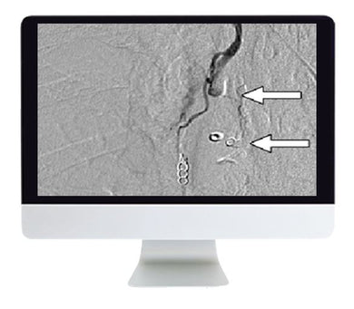ARRS Clinical Case-Based Review of Vascular and Interventional Imaging 2019 | Medical Video Courses.