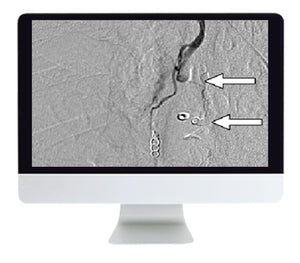 ARRS Clinical Case-Base Review sa Vascular ug Interventional Imaging 2019 | Mga Kurso sa Video nga Medikal.