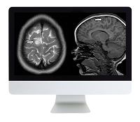 ARRS Clinical Pediatric Imaging Review 2017 | Medical Video Courses.