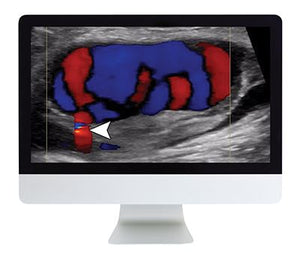 Tinjauan Ultrasound Klinis ARRS | Kursus Pidéo Médis.