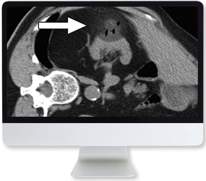 ARRS Cross-Sectional Renal Imaging: Techniques and Diagnosis 2020 | Medical Video Courses.