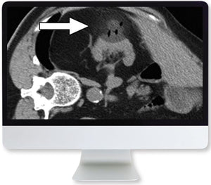 Imaging renale trasversale ARRS: tecniche e diagnosi 2020 | Corsi di video medici.