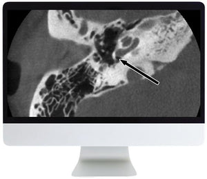 ARRS Mergullo profundo na radioloxía da cabeza e do pescozo 2020 | Cursos de vídeo médico.