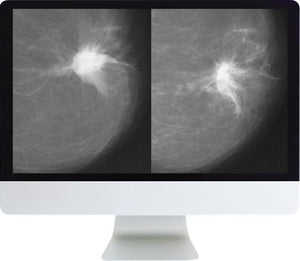 ARRS统一乳腺癌筛查建议混合课程2018 | 医学视频课程。