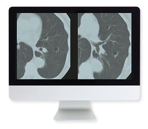 ARRS 폐암 검진 종합 가이드 온라인 과정 2015 | 의료 비디오 과정.