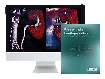 ARRS Oncologic Imaging From Diagnosis to Cure 2016 | Medical Video Courses.