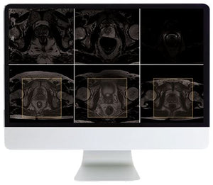 ARRS Перли и клопки в изображенията на простатата и таза 2021