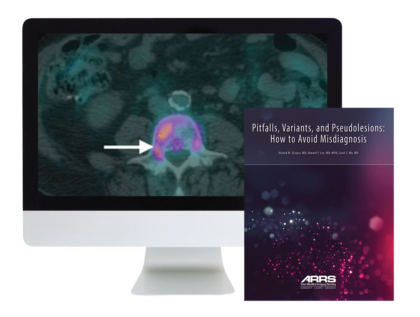 ARRS Pitfalls, Variants, and Pseudolesions: How to Avoid Misdiagnosis 2019 | Medical Video Courses.