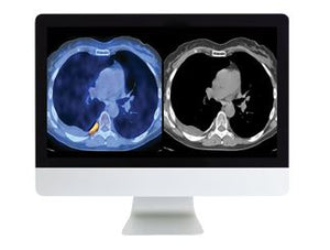 ARRS PET/CT Prático: O que você precisa saber | Cursos de vídeo médico.