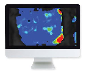 ARRS Prostate MRI Usa ka Practice-Based Approach | Mga Kurso sa Medikal nga Video.