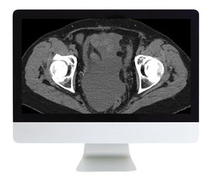 ARRS радиологиялық қорытындысы Жылдам өртке қарсы мамандандырылған шолу 2018 | Медициналық бейне курстар.
