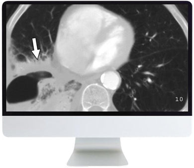 ARRS Radiology Review: Multispecialty Cases 2019 | Medical Video Courses.