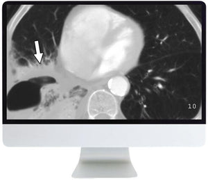 ARRS Radiology Review: Multispecialty Cases 2019 | Cursos de vídeo médico.