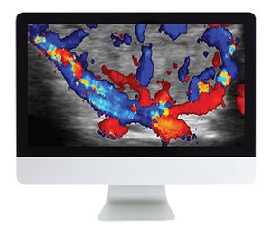 Imaxe de tiroides ARRS | Cursos de vídeo médico.