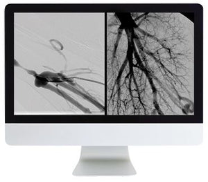 Revisão de Radiologia Vascular e Intervencionista ARRS 2016 | Cursos de vídeo médico.