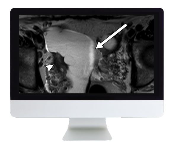 ARRS Women's Imaging 2019 | Medical Video Courses.