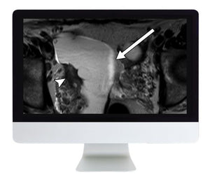 ARRS Women's Imaging 2019 | Lékařské video kurzy.