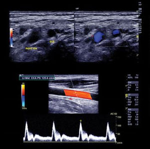 Pendekatan klinis kana Vaskular Ultrasound sareng RPVI Prep Kursus 2021 | Kursus Pidéo Médis.