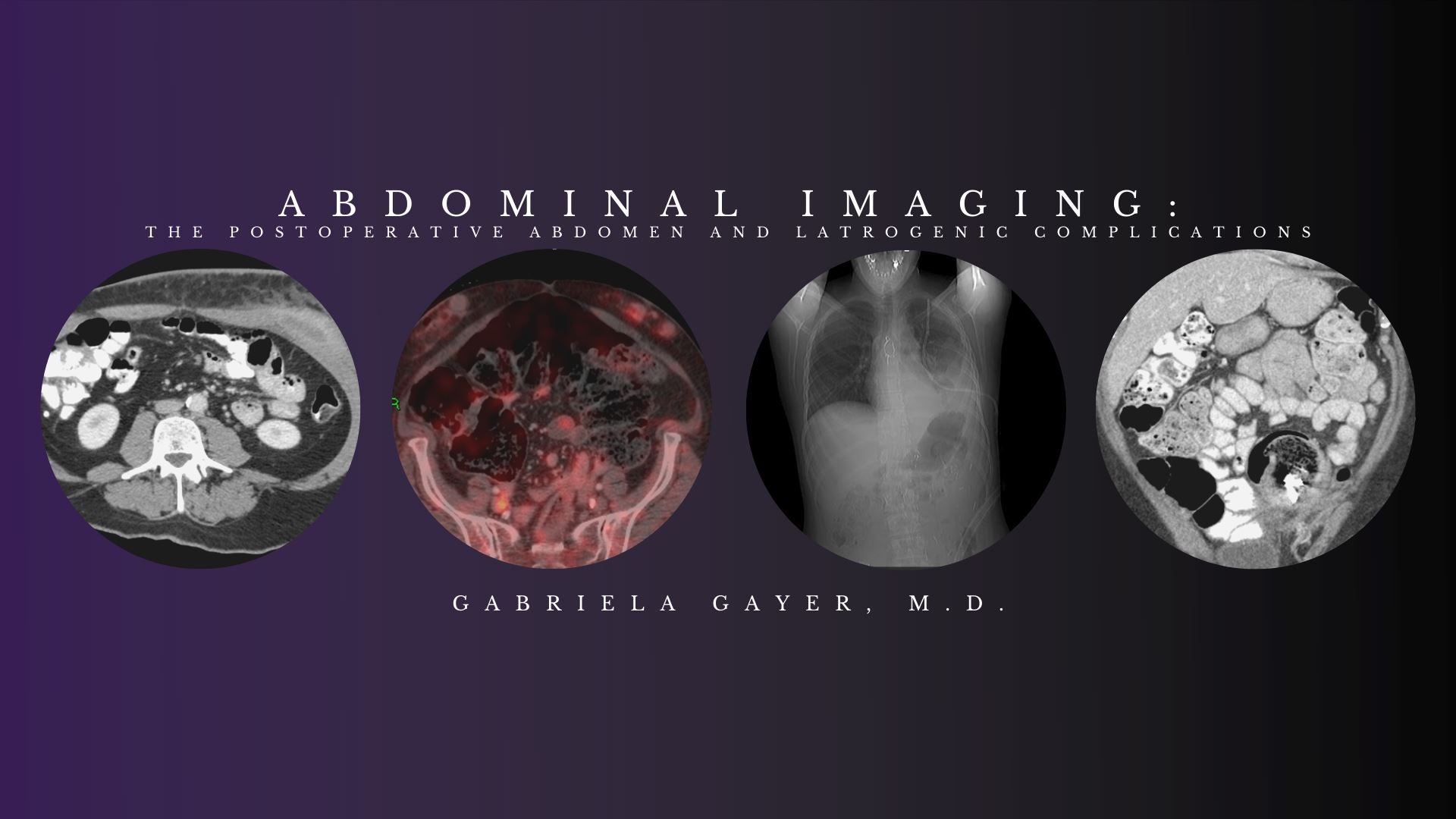 CME Science Abdominal Imaging – Gabriela Gayer, M.D.