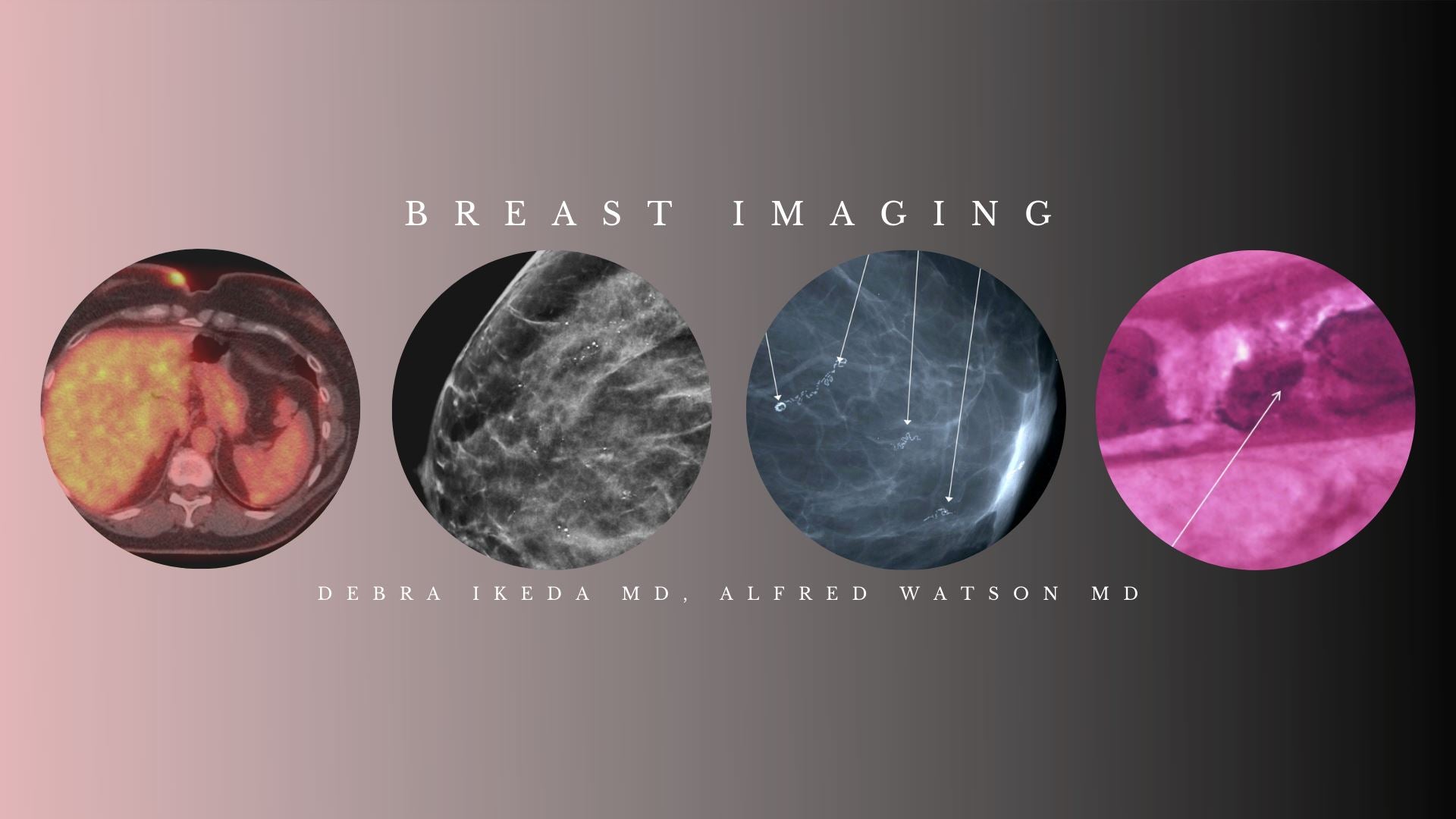 CME Science Breast Imaging (BUNDLE) – Debra Ikeda M.D., Alfred Watson M.D 2020 | Medical Video Courses.