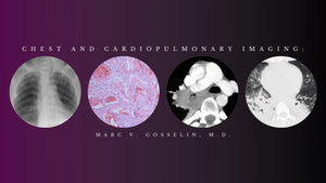 सीएमई साइंस चेस्ट और कार्डियोपल्मोनरी इमेजिंग - मार्क वी। गोस्सेलिन, एमडी (वीडियो + पीडीएफ) | चिकित्सा वीडियो पाठ्यक्रम।