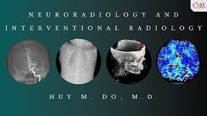 CME Science Neuroradiologie și radiologie intervențională 2020 | Cursuri video medicale.
