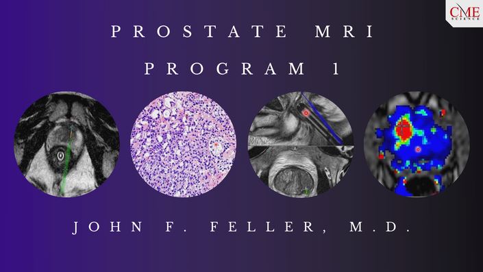 CME Science Prostate MRI (Program 1) – John F. Feller, M.D. | Medical Video Courses.
