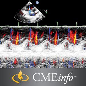 Echocardiography – A Comprehensive Review 2020 | Medical Video Courses.