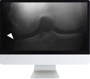 2018 年放射科医生的 ARRS 肌肉骨骼成像 | 医学视频课程。