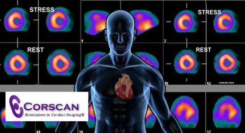Nuclear Cardiology Board Review 2018 | Medical Video Courses.