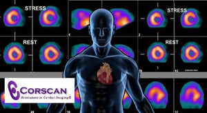 Преглед на одбор за нуклеарна кардиологија 2018 | Курсеви по медицинско видео.